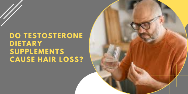 Do testosterone dietary supplements cause hair loss | UK Steroids Shop