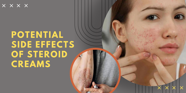 Potential Side Effects of Steroid Creams | UK Steroids Shop