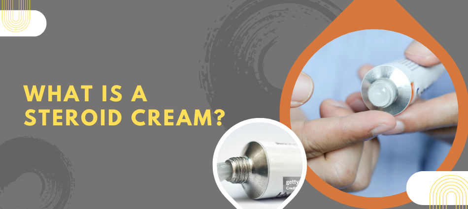 What is a Steroid Cream