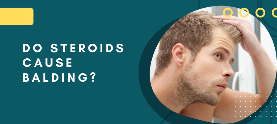 Do Steroids Cause Balding
